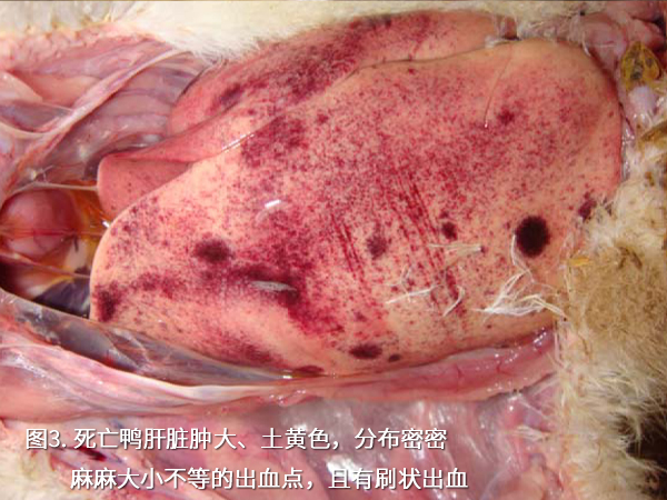 死亡鴨肝臟腫大、土黃色，分布密密麻麻大小不等的出血點，且有刷狀出血